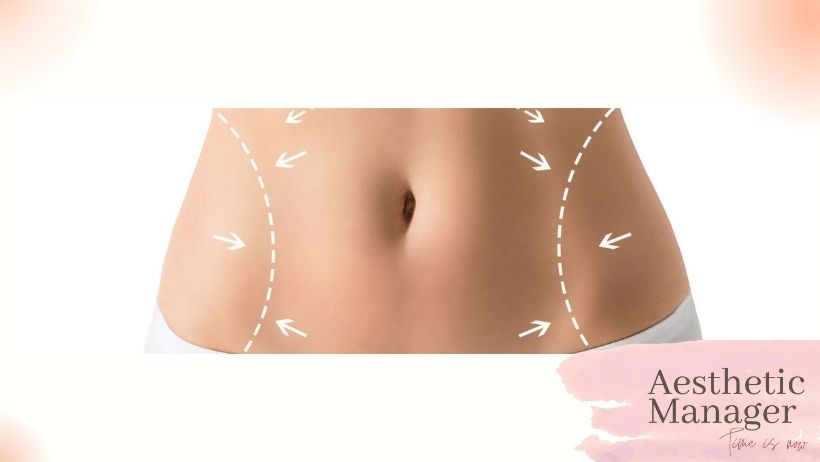 Sagging, cracks, and lubrication caused by cesarean section, pregnancy, and constant weight gain and loss are easily removed by aesthetic surgery.